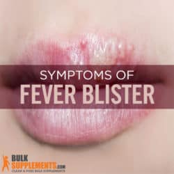 Fever Blisters: Causes, Symptoms & Treatments | BulkSupplements