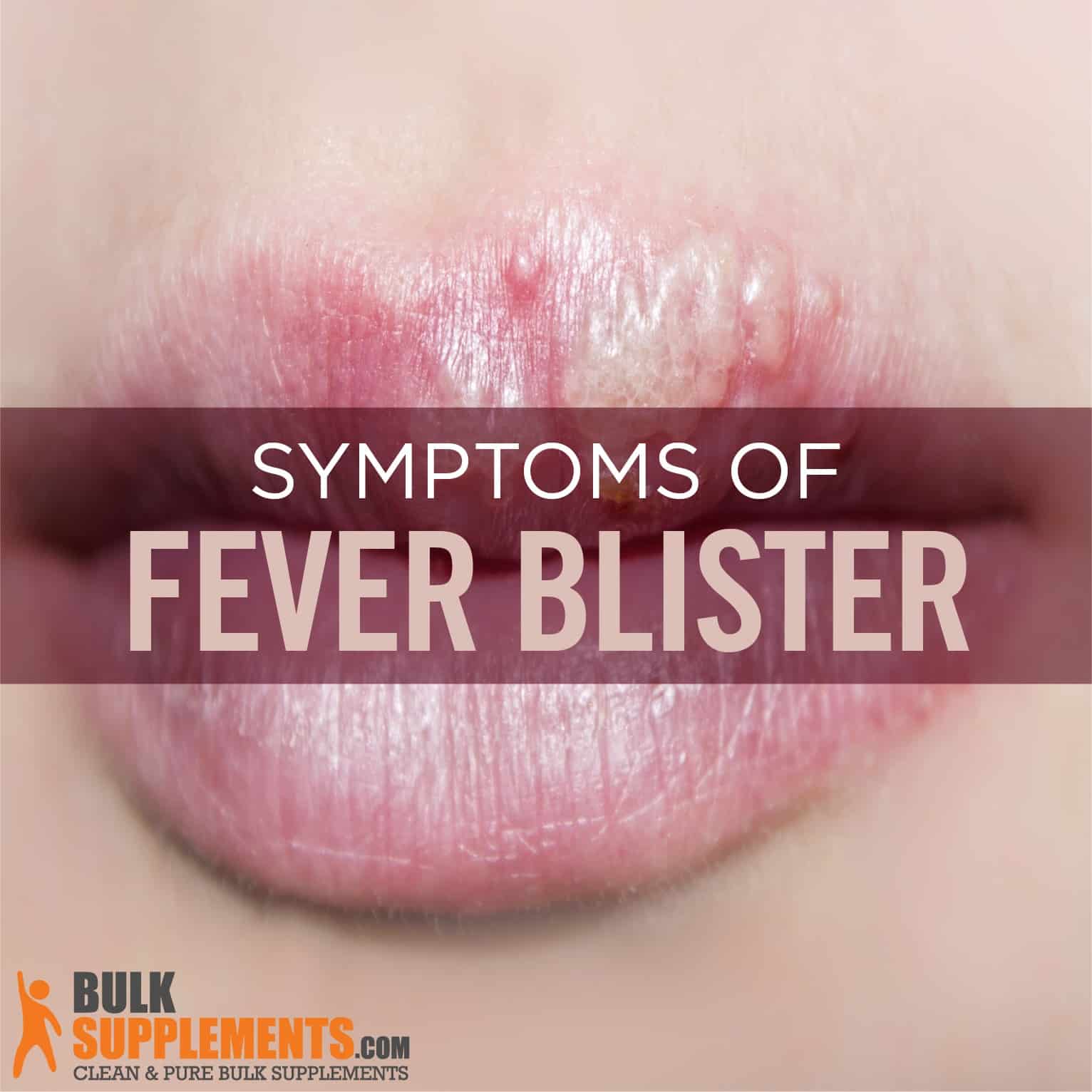 \u0026 Symptoms Blisters: BulkSupplements Causes, Treatments | Fever