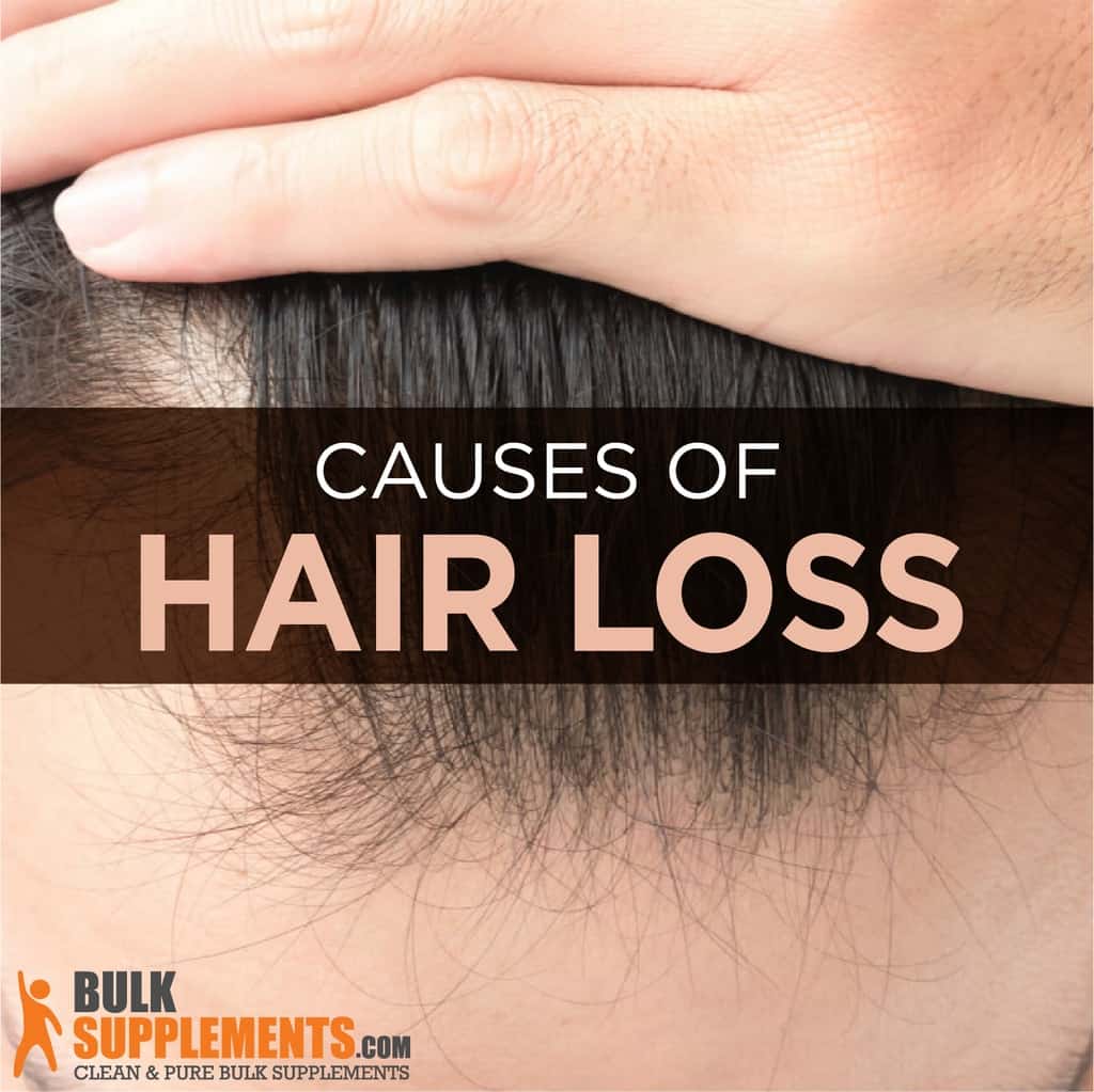 Hair Loss Characteristics Causes Treatment
