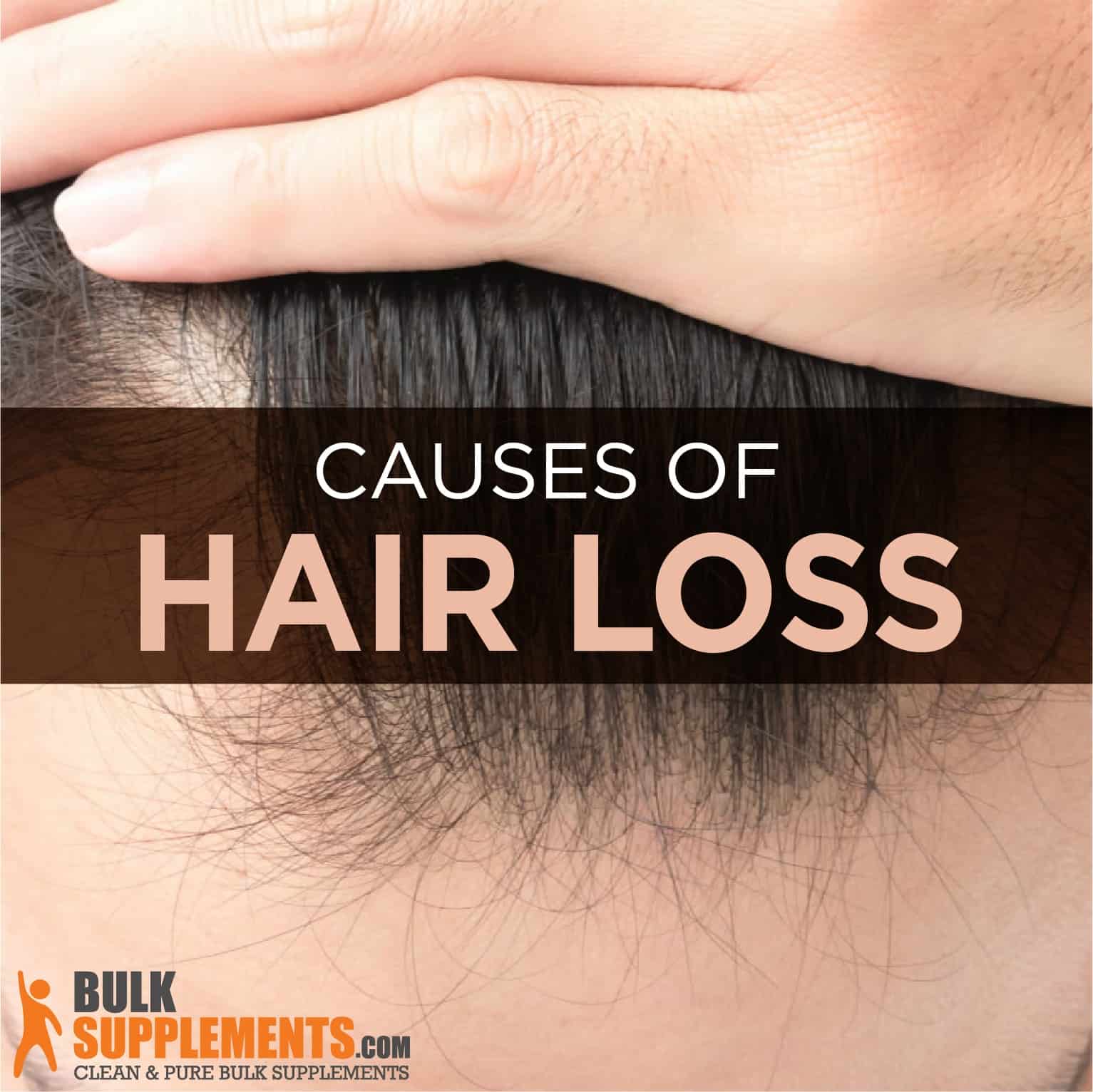 Hair Loss