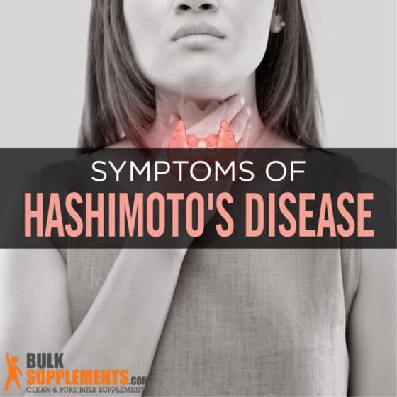 Hashimoto S Disease Symptoms Causes And Treatment