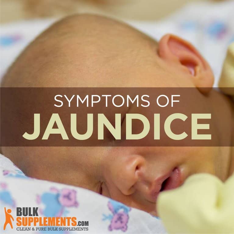 What is Jaundice Symptoms, Causes & Remedies