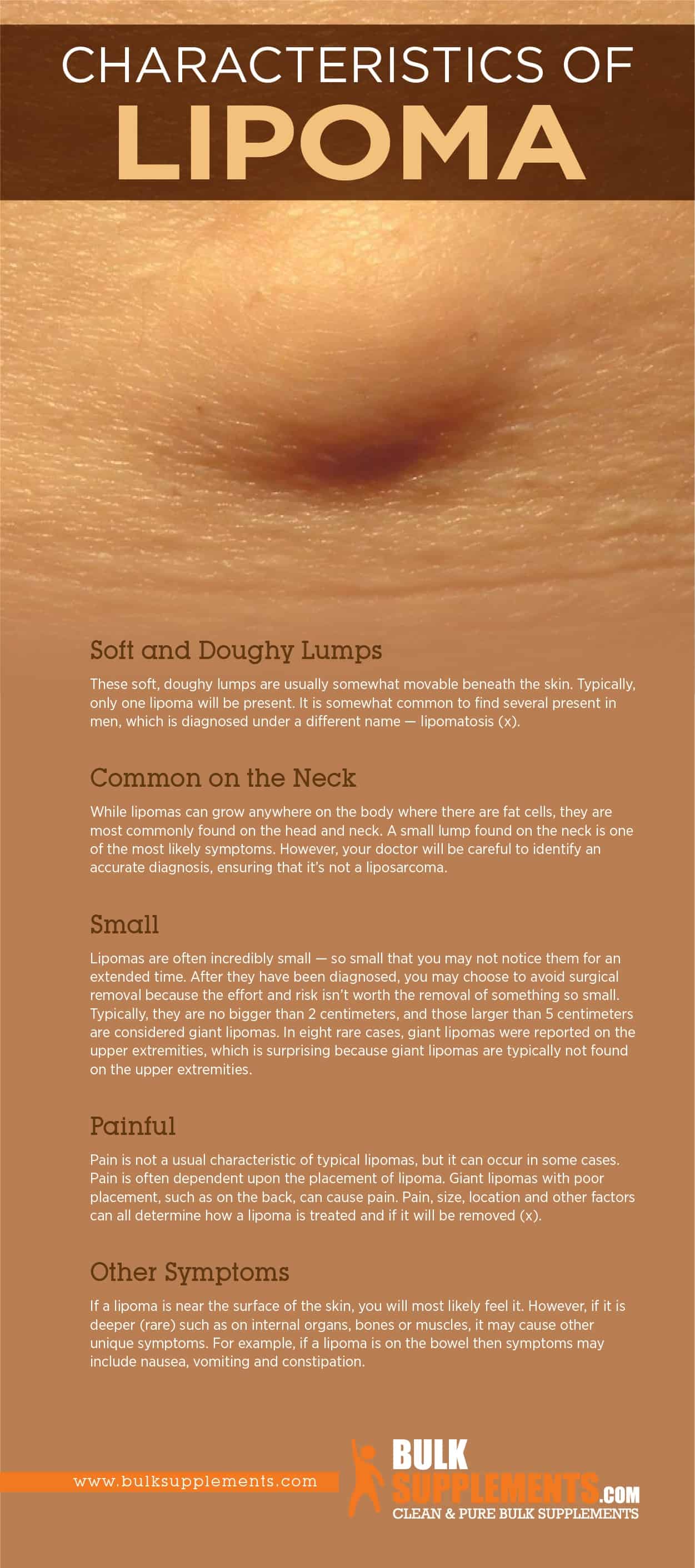 Lipoma Characteristics