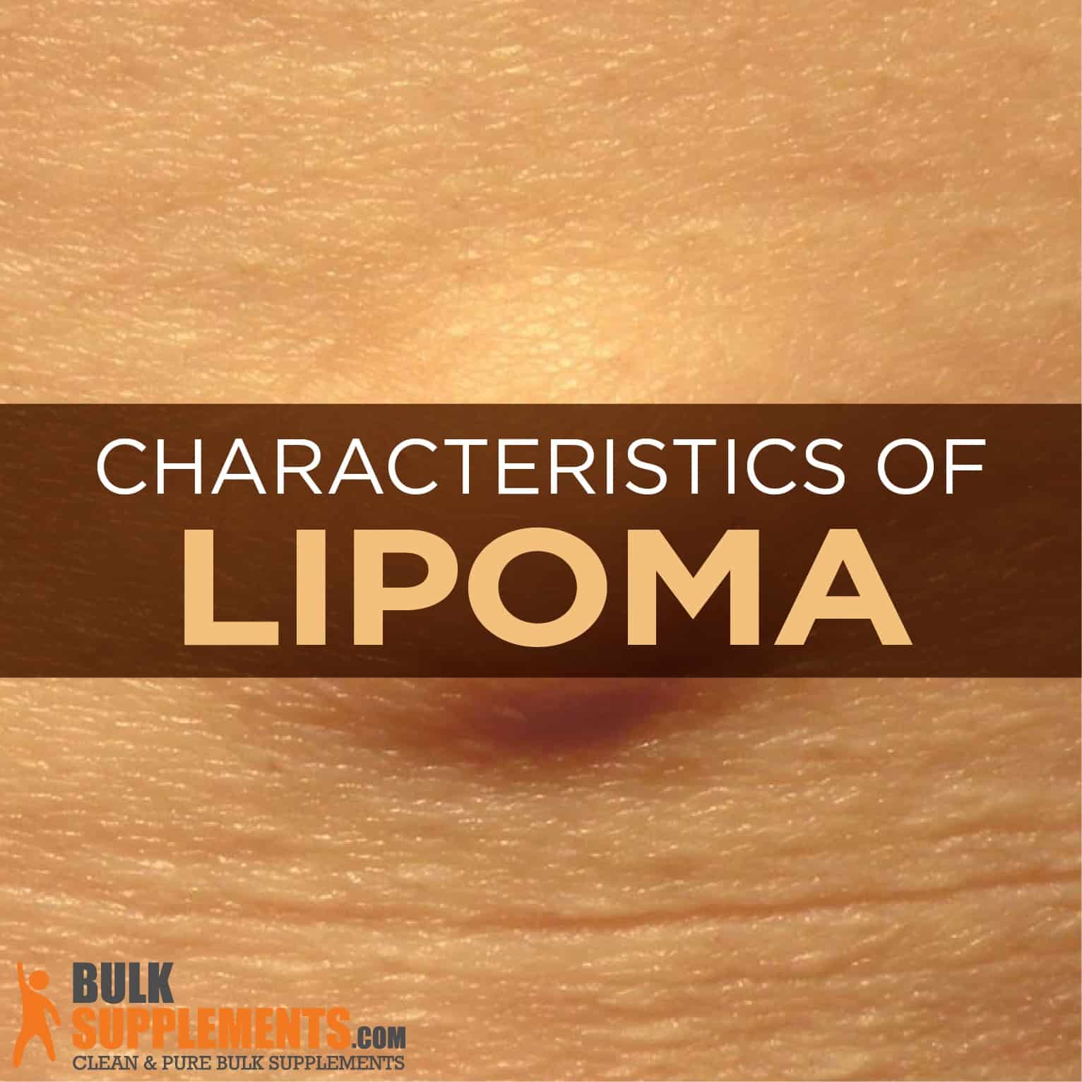 Lipoma