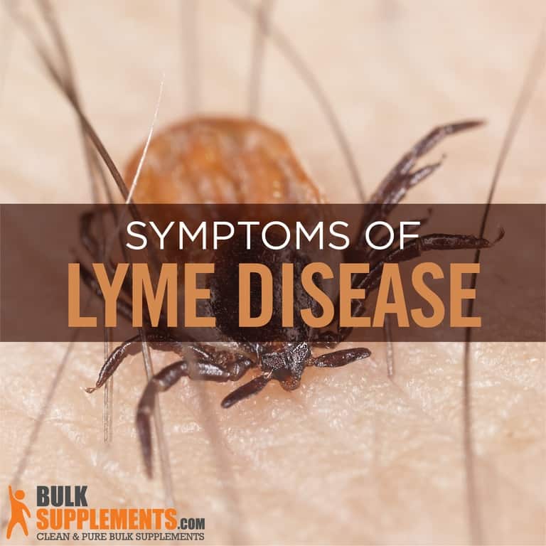 Lyme Disease: Symptoms, Causes & Treatment