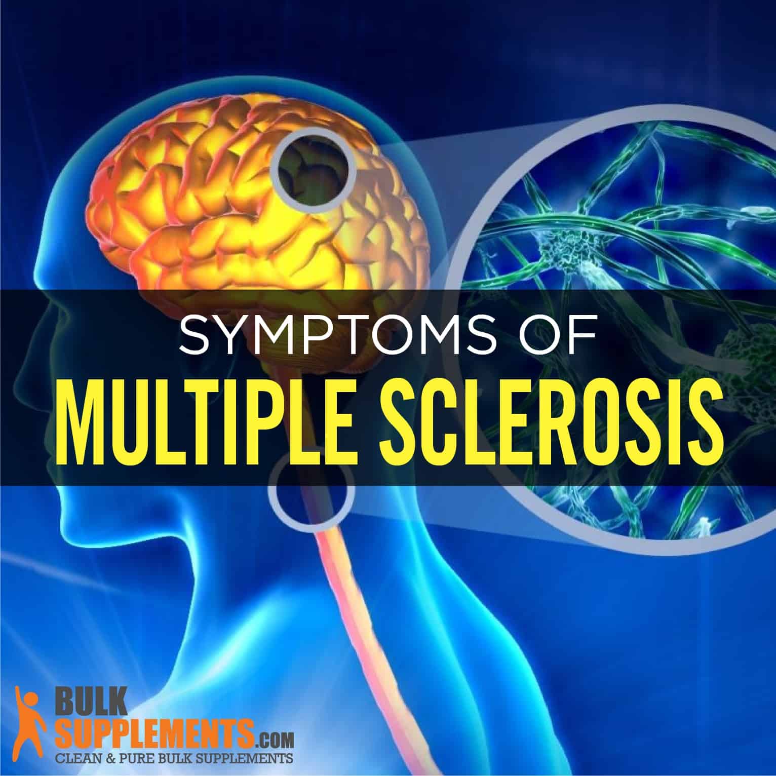 Multiple Sclerosis