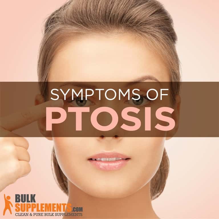 everything-you-need-to-know-about-ptosis