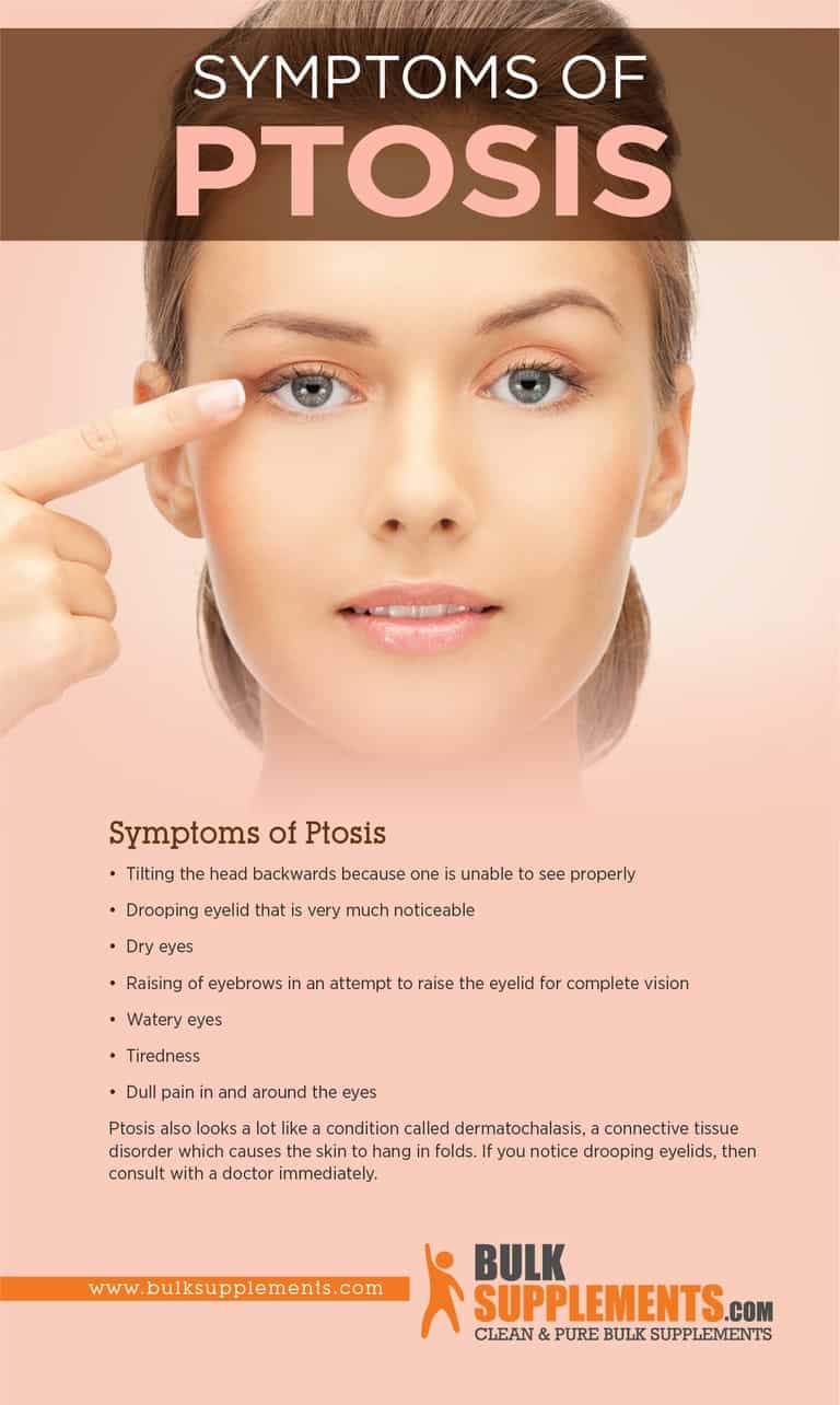 Ptosis Symptoms, Causes & Treatment