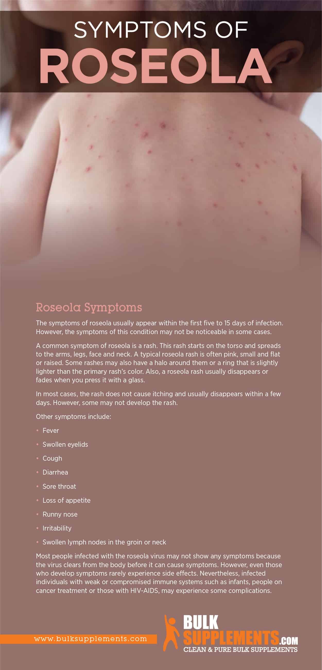 Roseola Symptoms Causes Treatment By James Denlinger