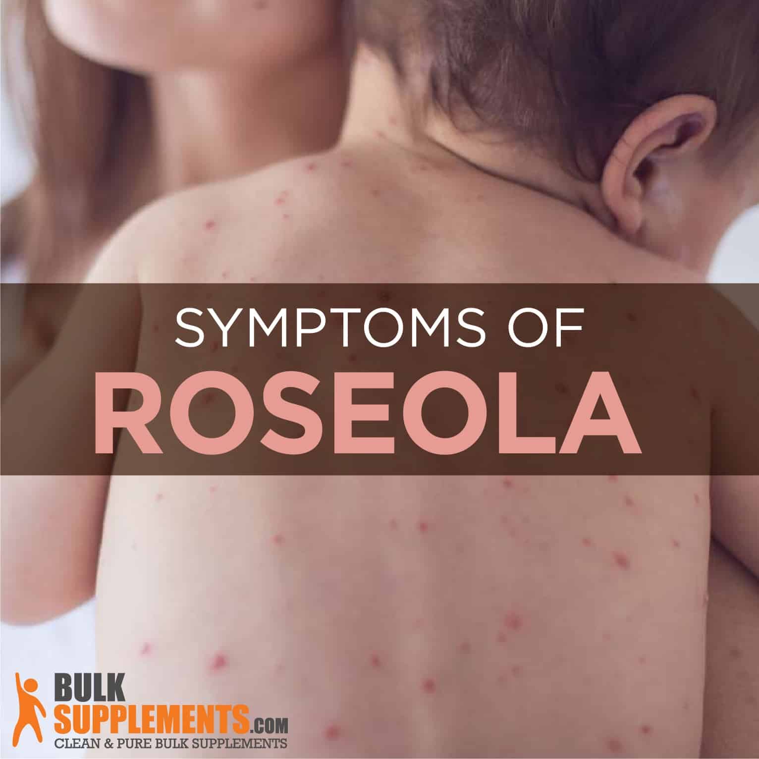 Roseola