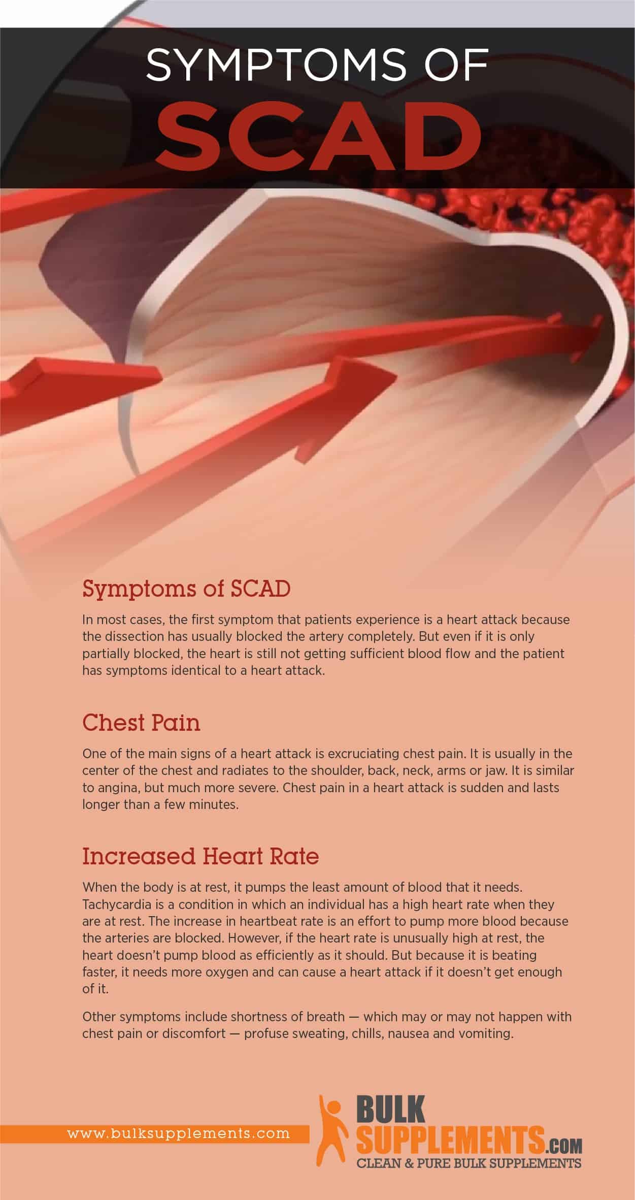 SCAD Symptoms