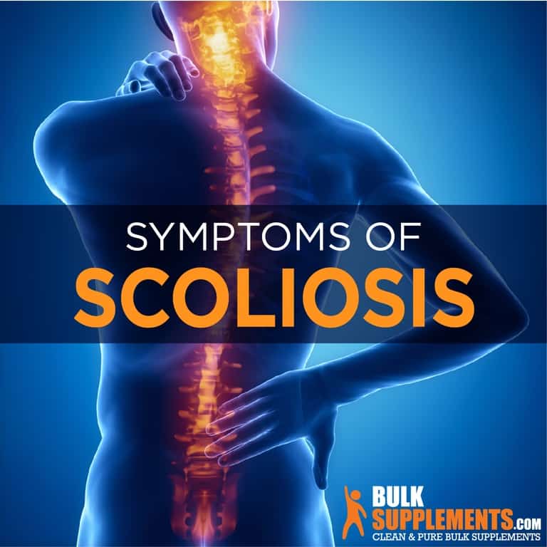 Scoliosis: Symptoms, Causes & Treatment