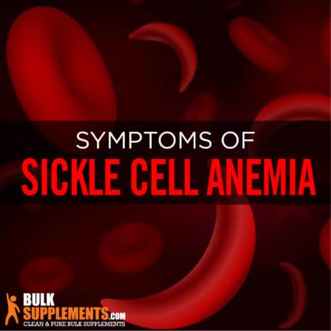 Sickle Cell Anemia: Symptoms, Causes & Treatment