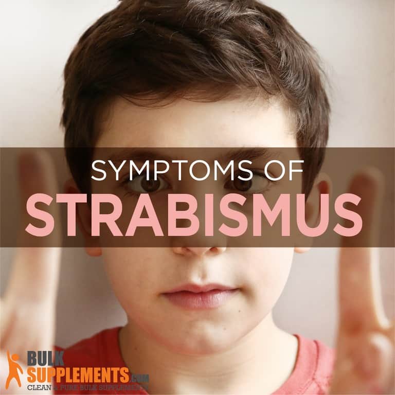 What Is Strabismus Causes Symptoms And Treatment