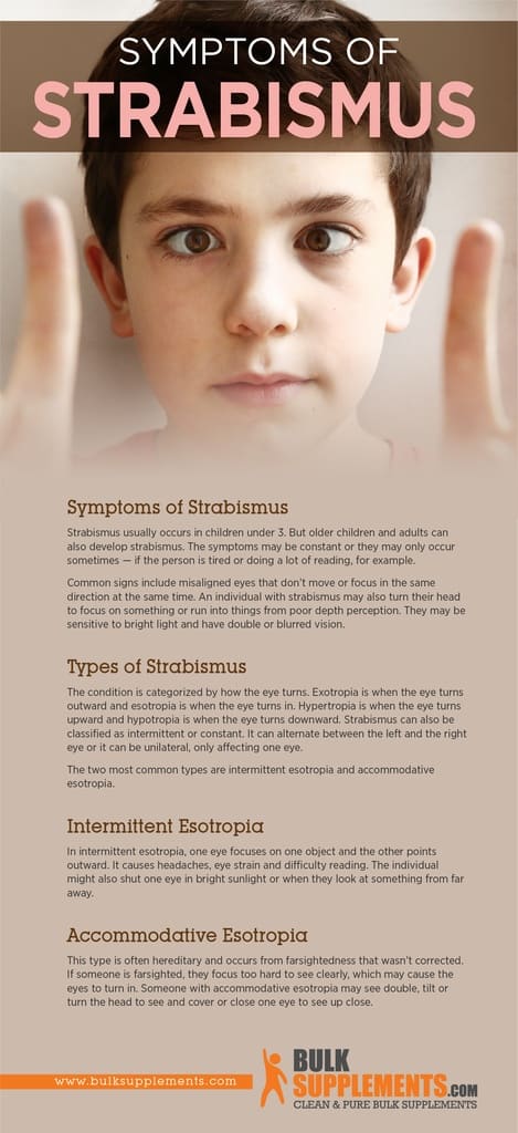 What Is Strabismus Causes Symptoms And Treatment 