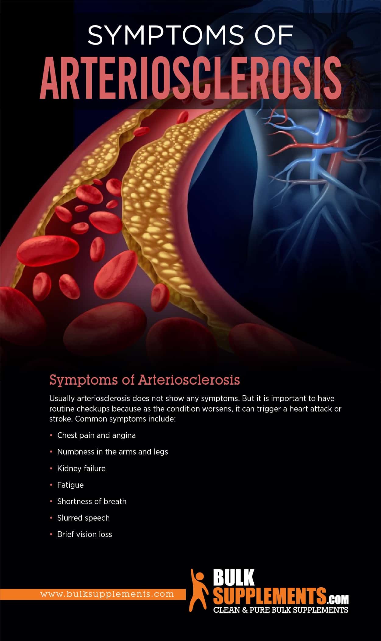 Arteriosclerosis Symptoms