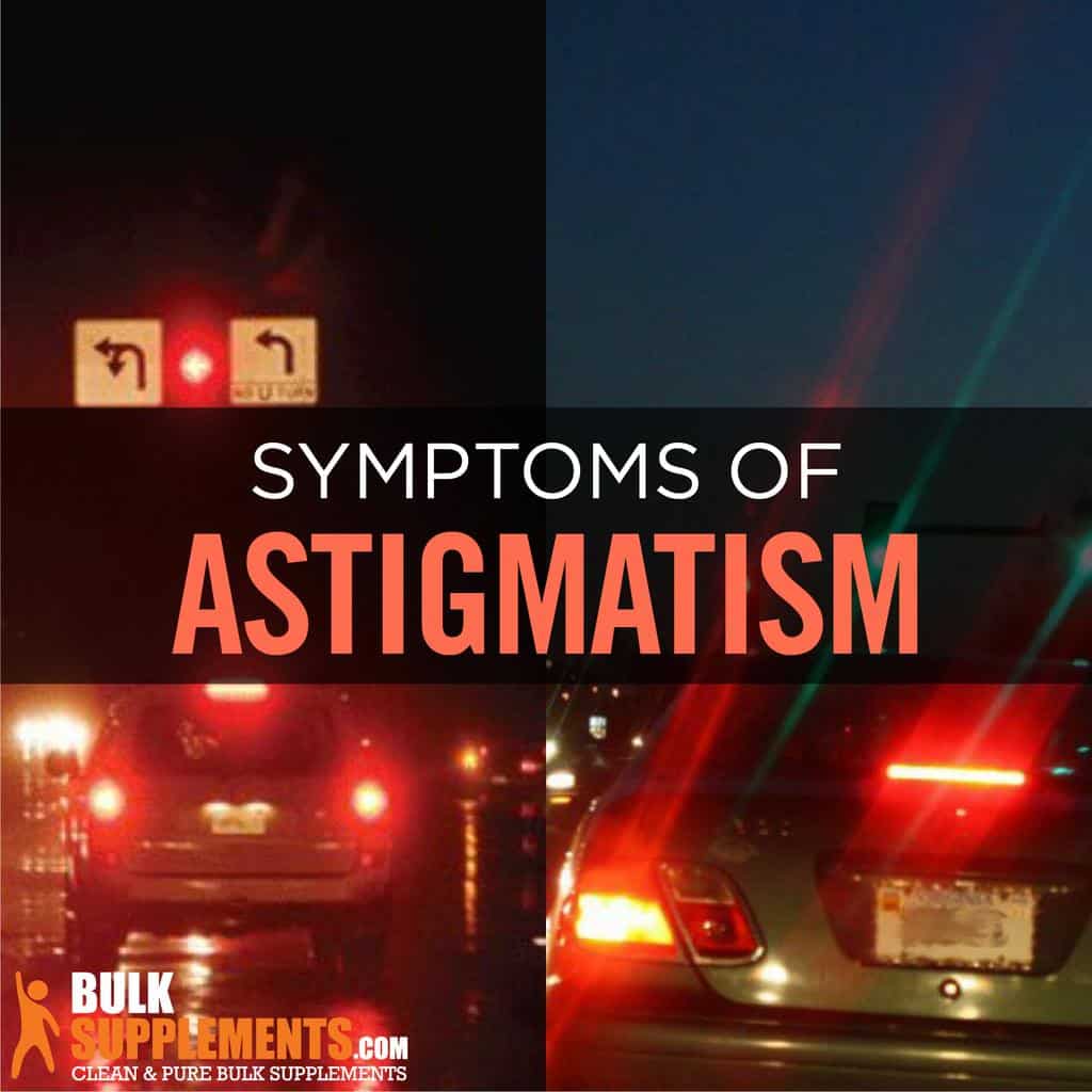 Astigmatism: Symptoms, Tests & Treatment