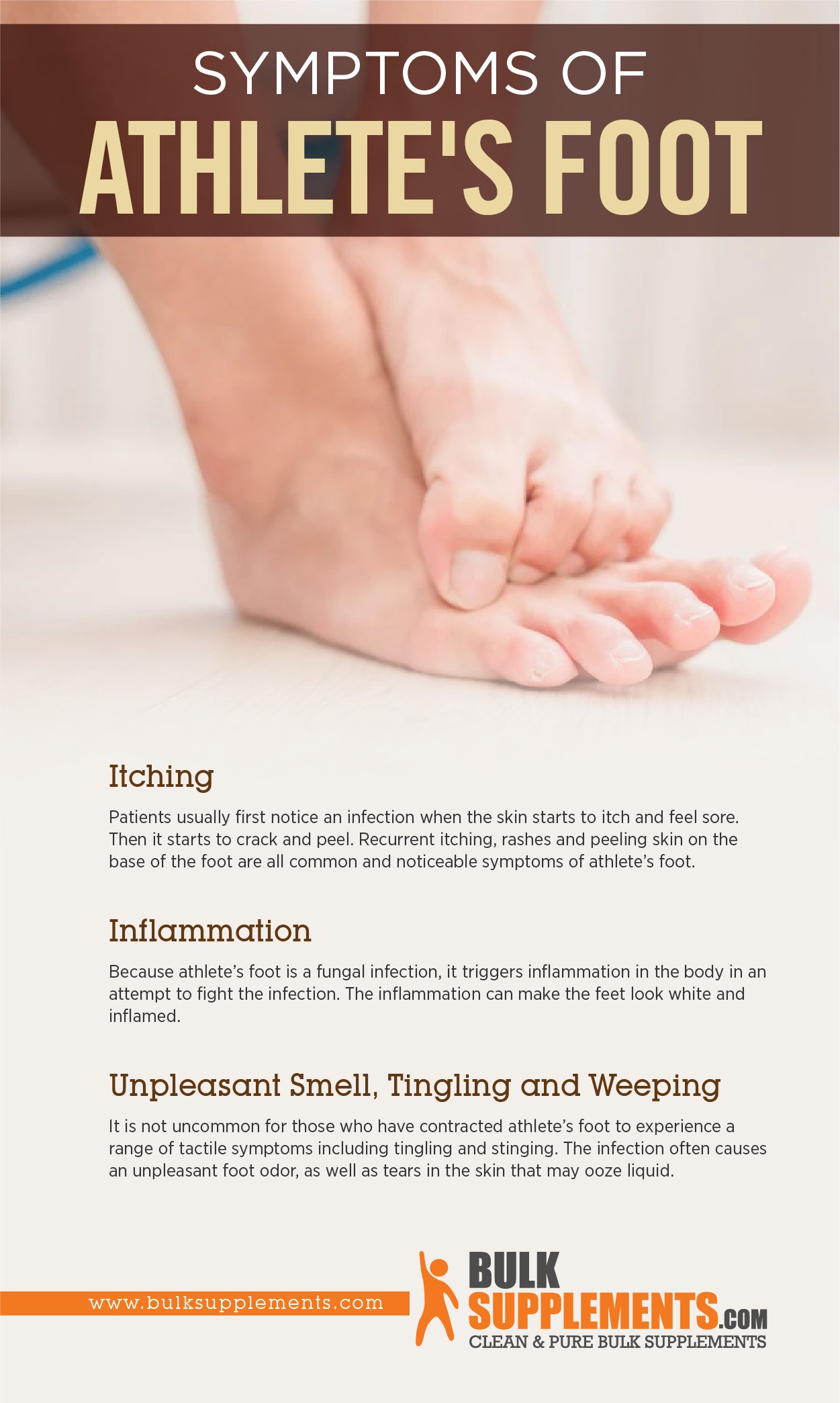 Athlete's Foot (Tinea pedis): Symptoms, Causes & Treatment - Foot