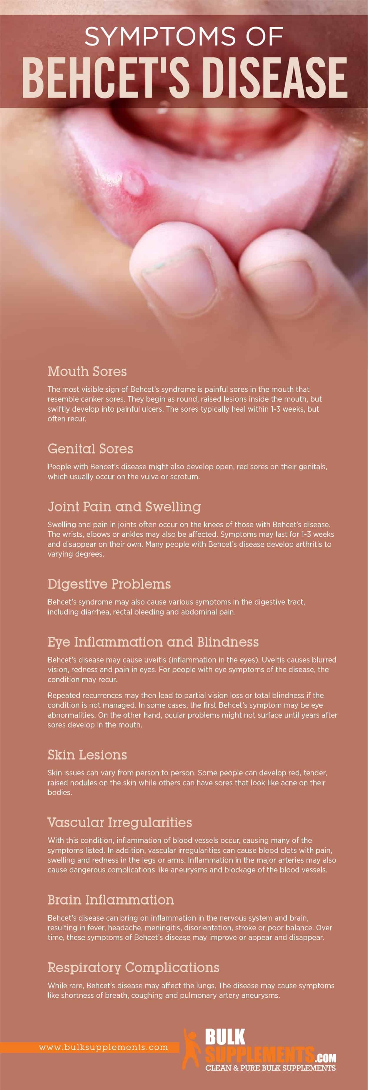 Symptoms of Behcet's Disease