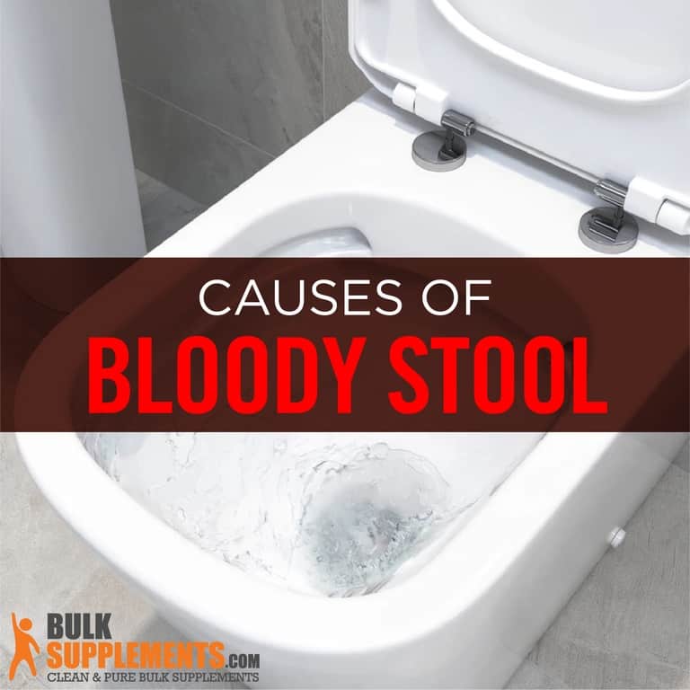Rectal Bleeding (Bloody Stool) Causes, Symptoms & Treatment