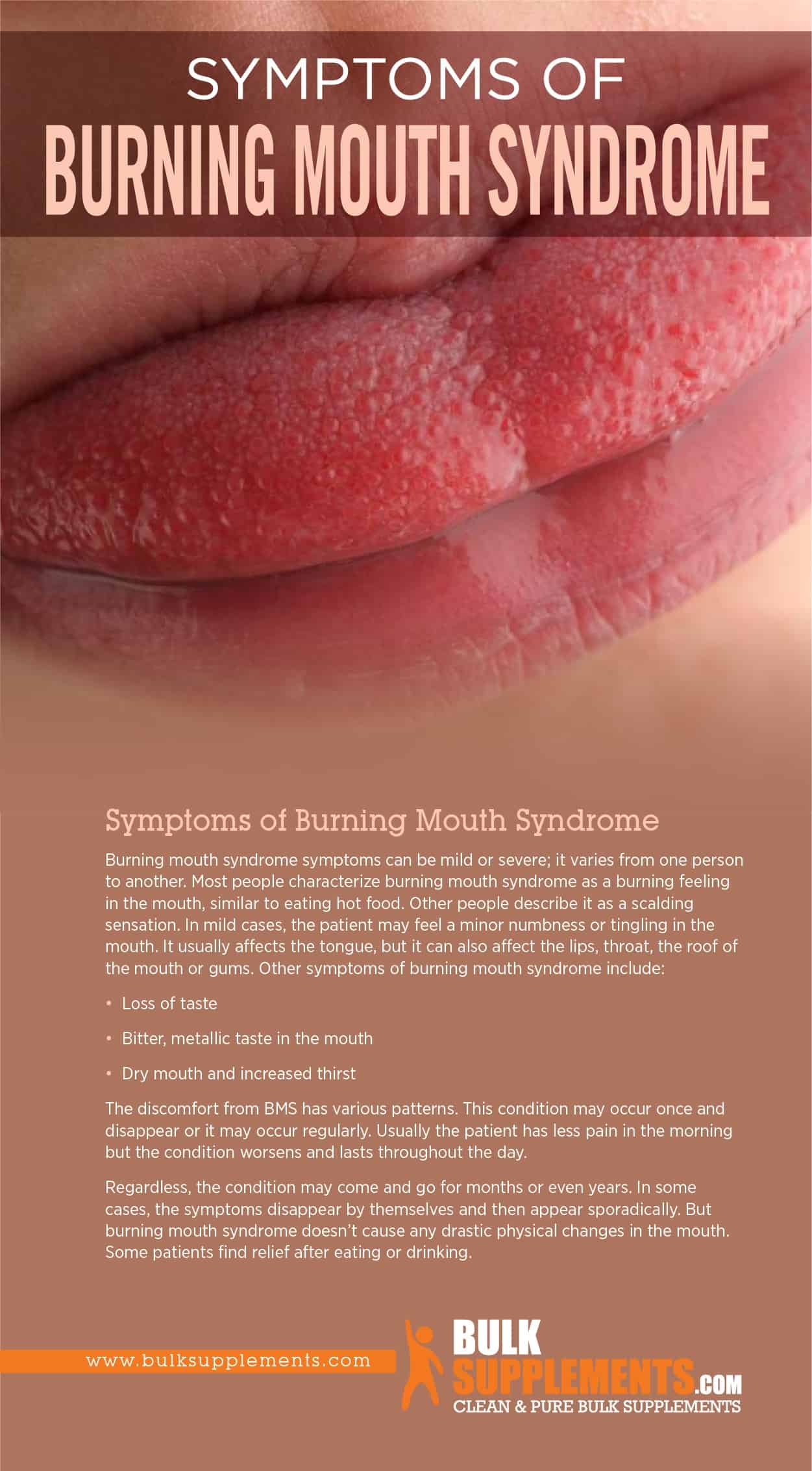 Burning mouth syndrome что это