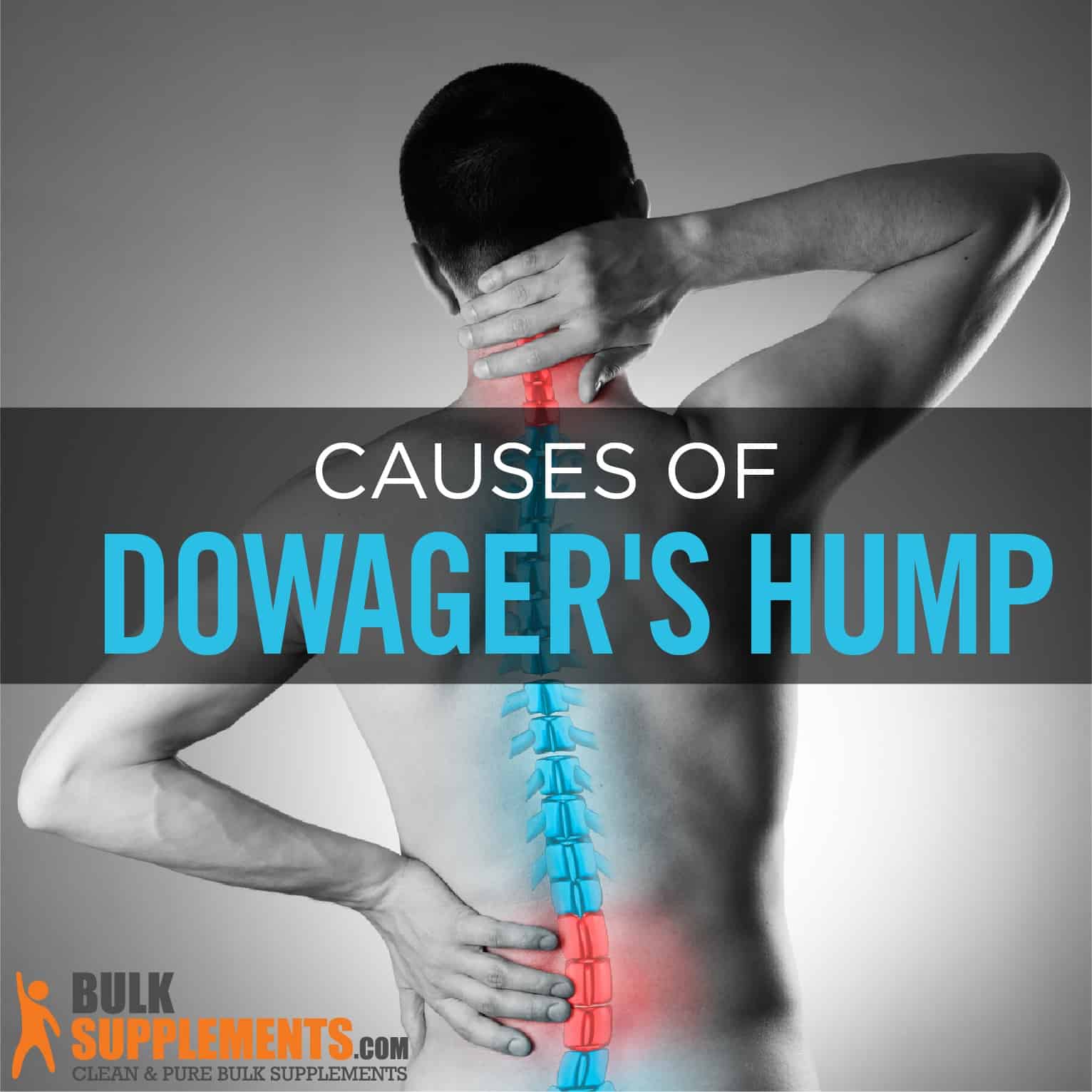 Understanding Dowager's Hump: Causes, Symptoms & Exercises