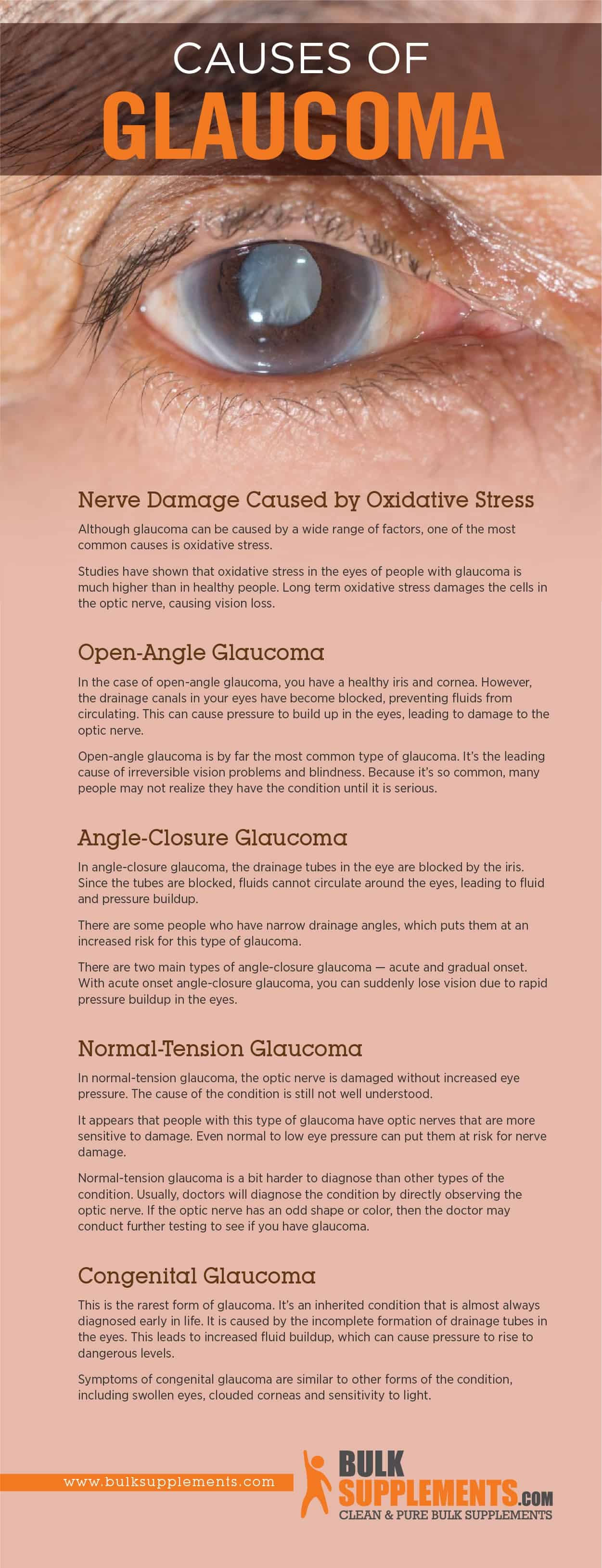 glaucoma-symptoms-causes-treatment-by-james-denlinger