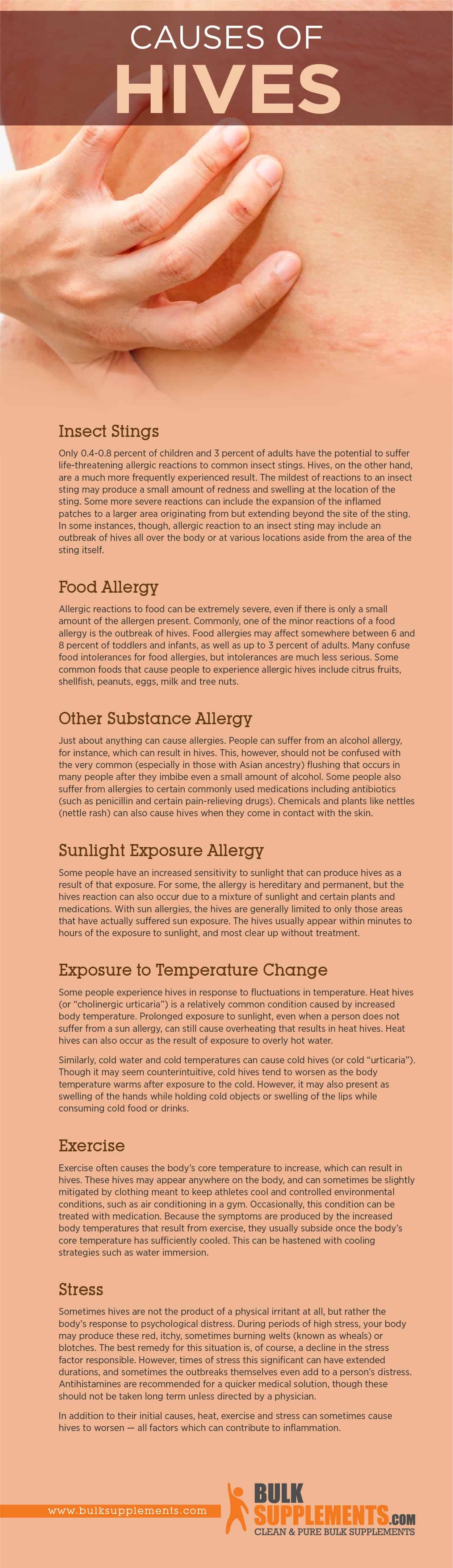 Causes of Hives