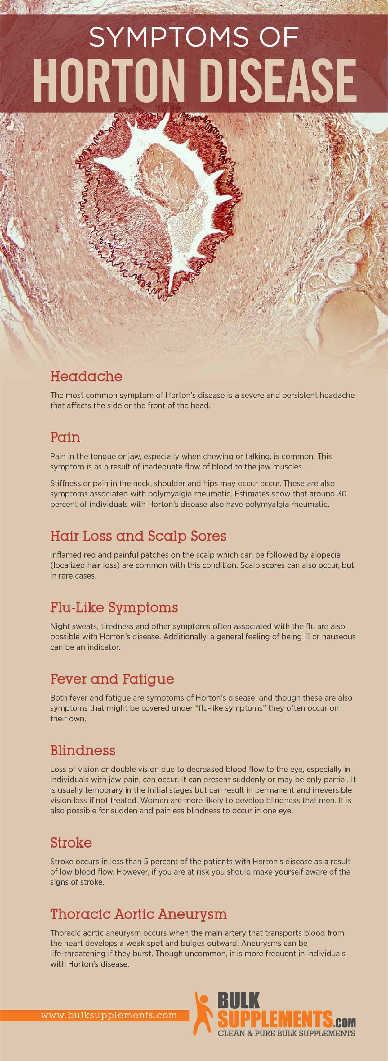 Symptoms of Horton Disease