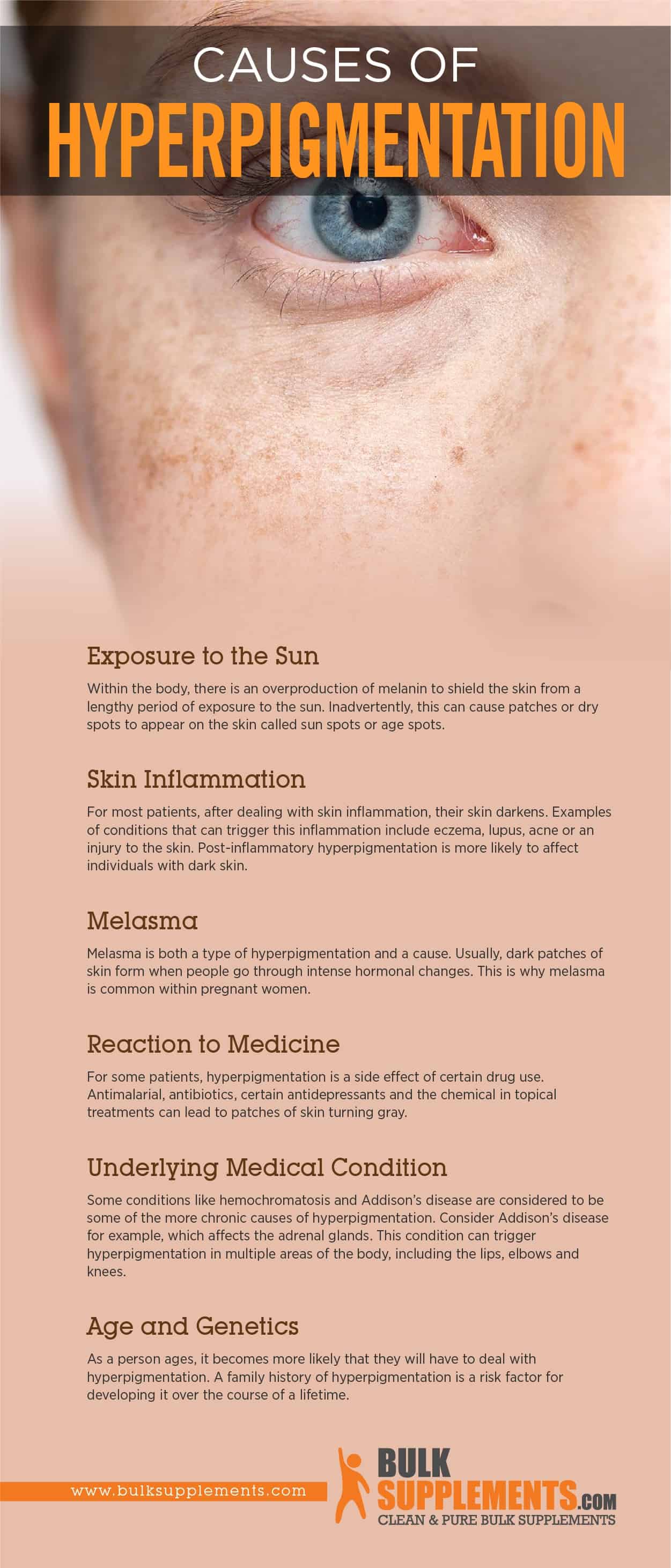 Causes of Hyperpigmentation