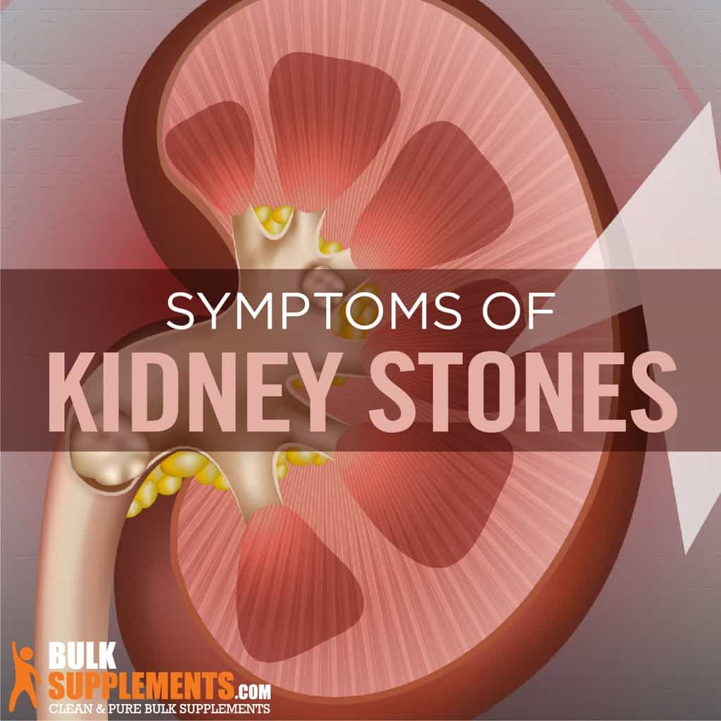 Kidney Stones Symptoms Causes And Treatment