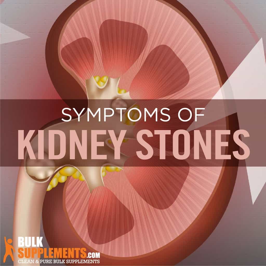 kidney-stones-symptoms-causes-treatment