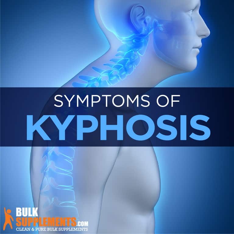 Kyphosis: Symptoms, Causes & Treatment