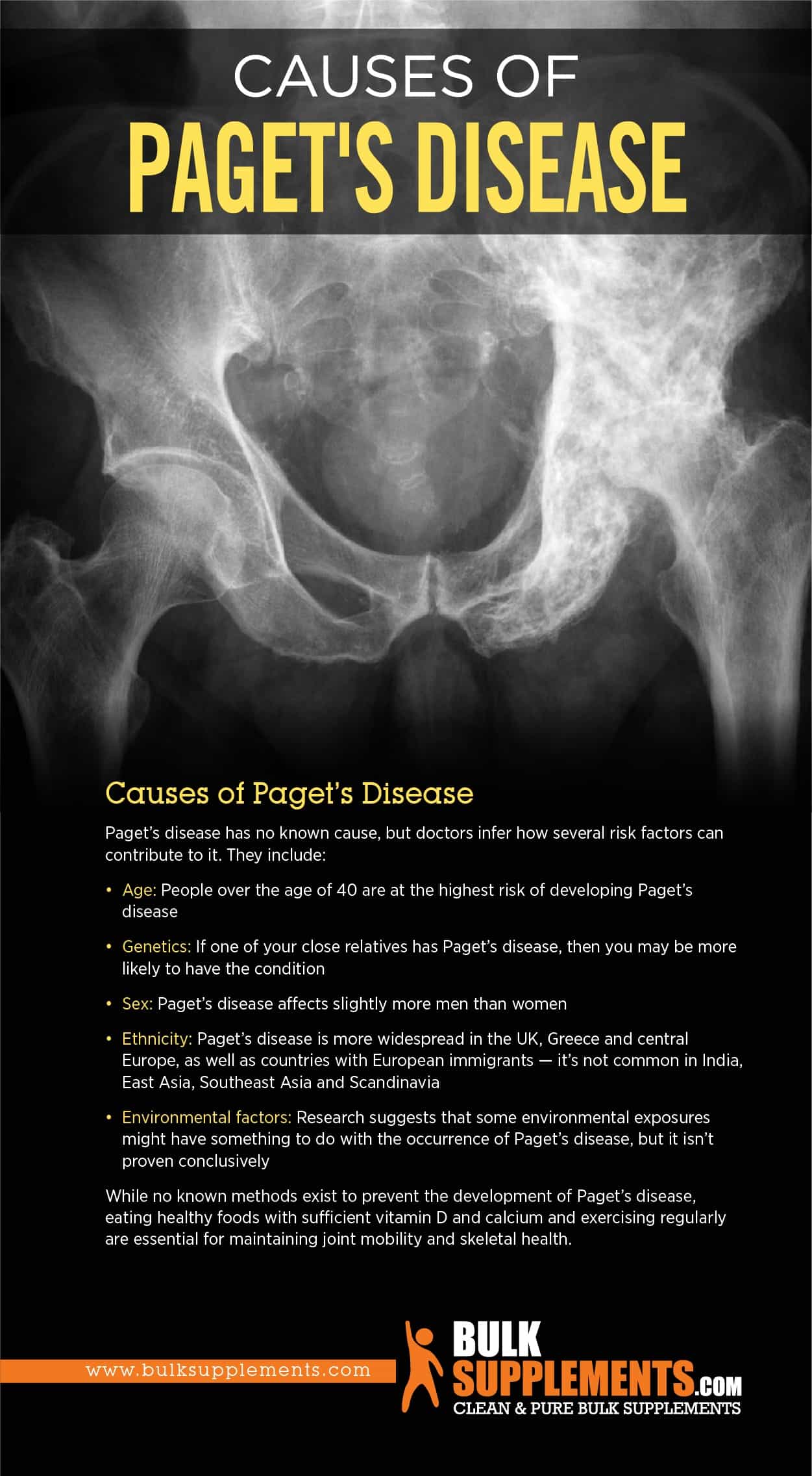 Paget's Disease: Symptoms, Causes & Treatment | BulkSupplements.com