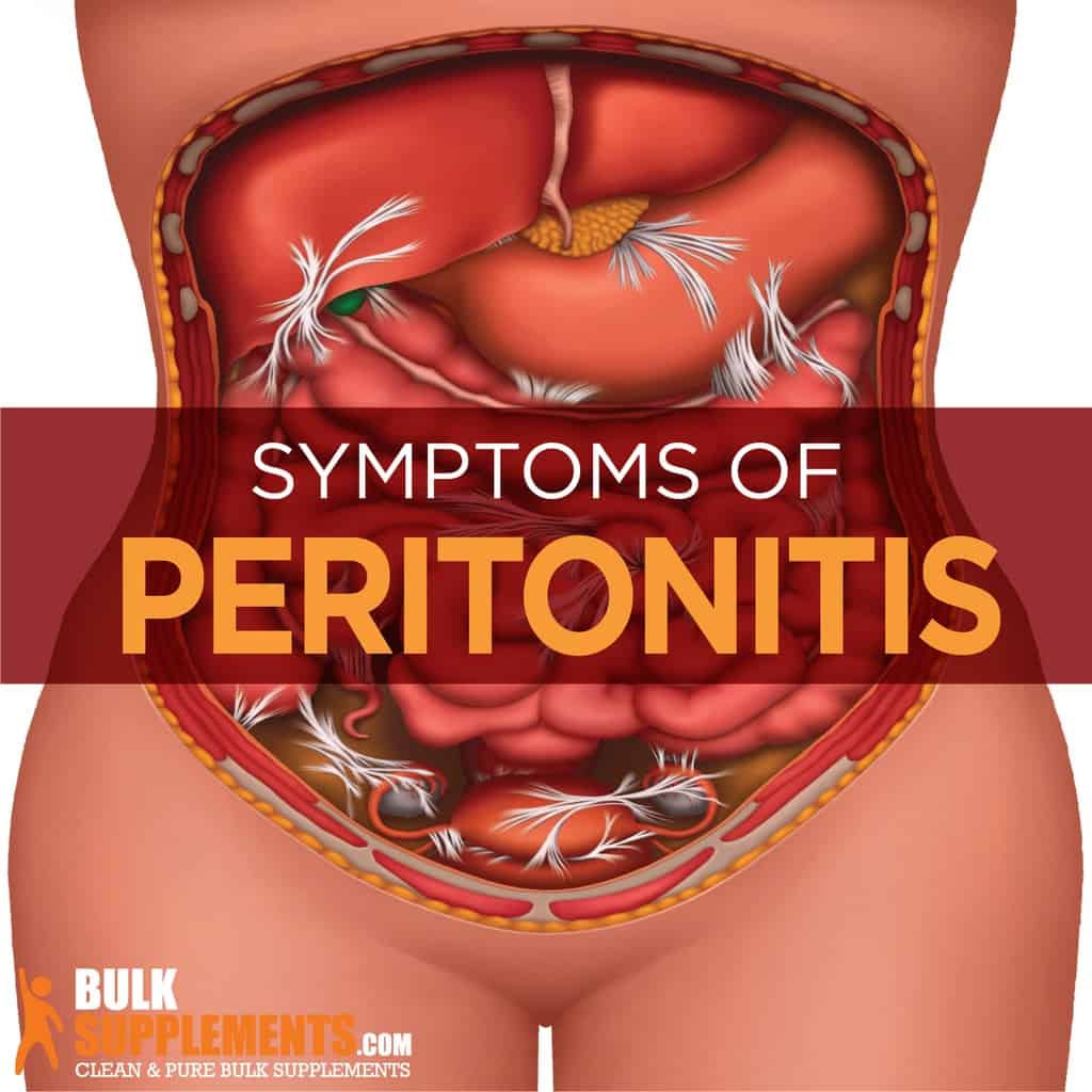 peritonitis-symptoms-causes-treatment