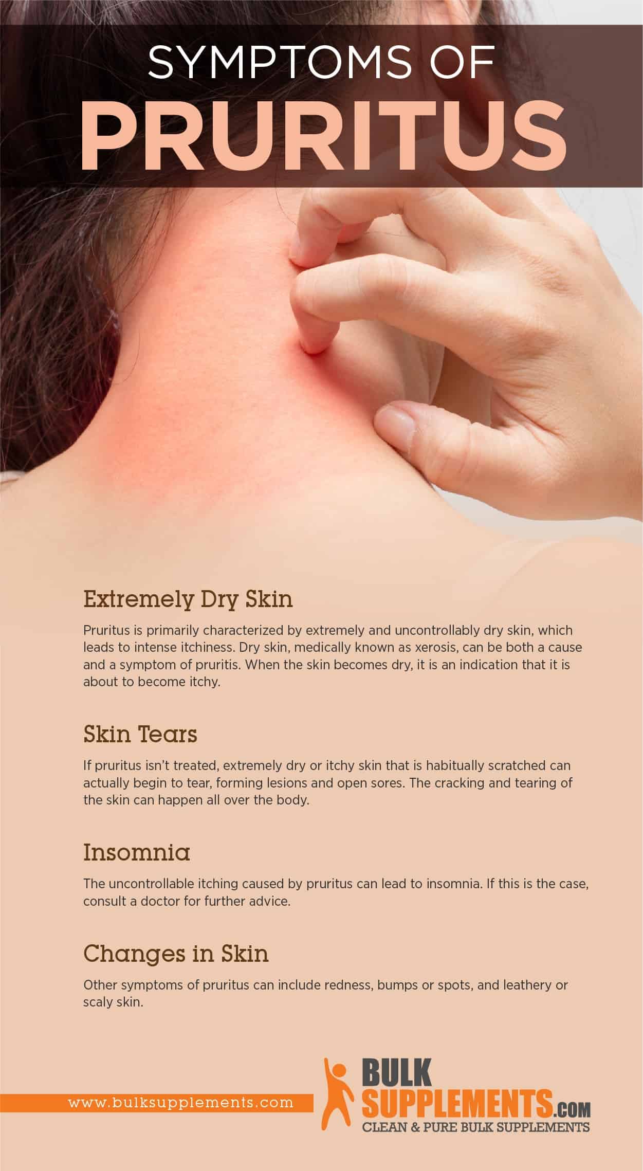 Dry Itchy Skin Symptoms