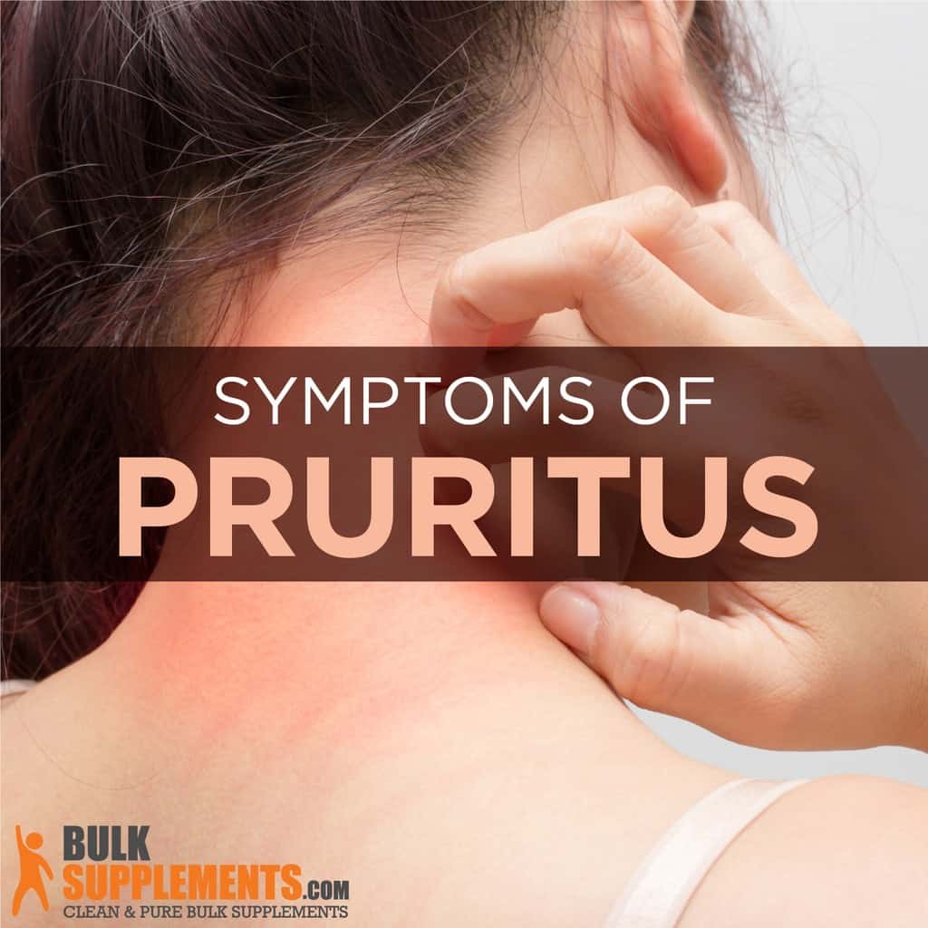 Pruritus (Itchy Skin): Symptoms, Causes & Treatment