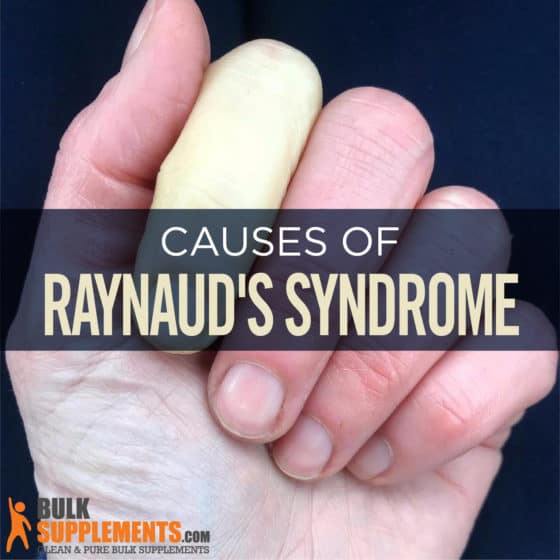 Raynaud's Syndrome: Symptoms, Causes & Treatment