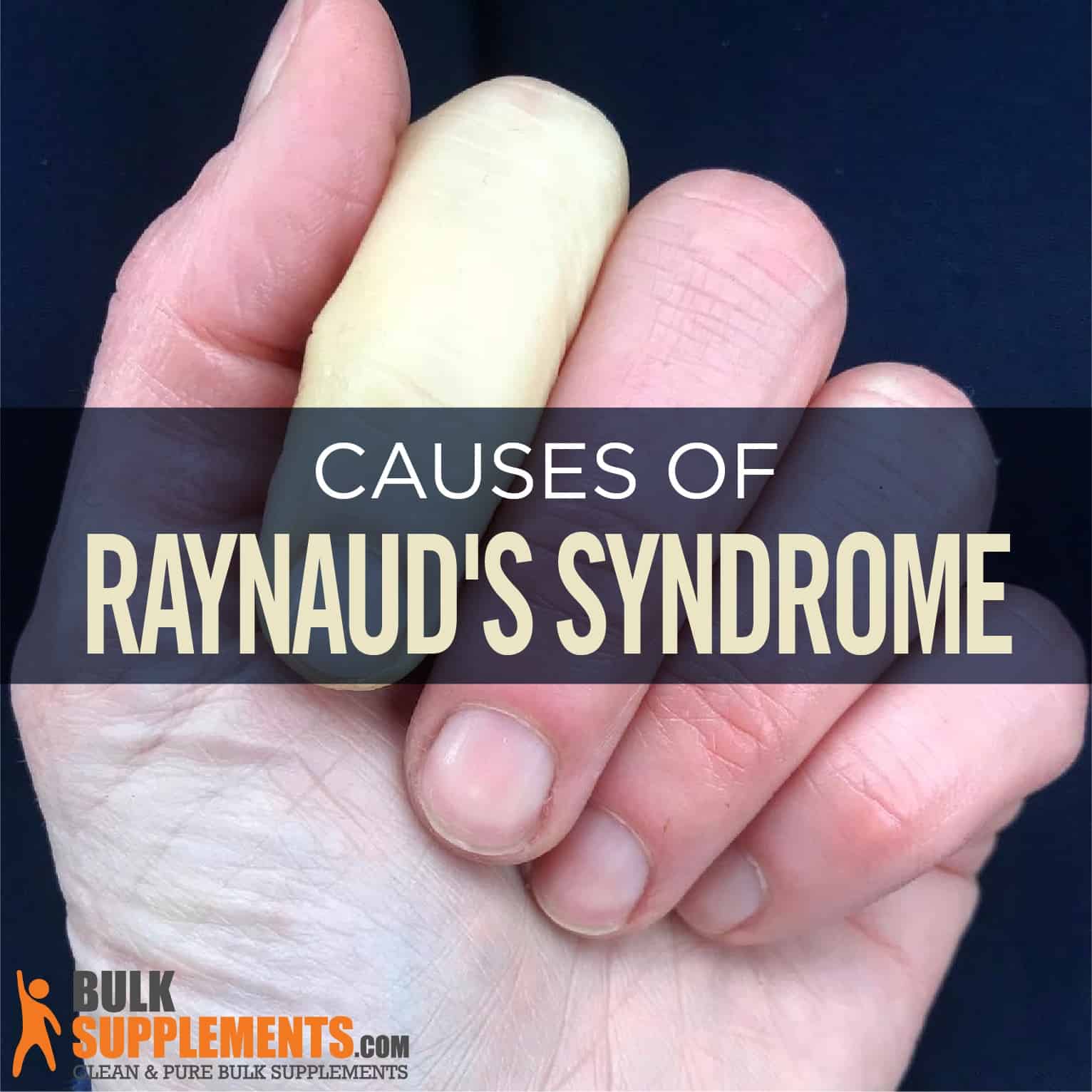 Cold Fingers, 6 Causes, Raynaud's Disease, & What To Do