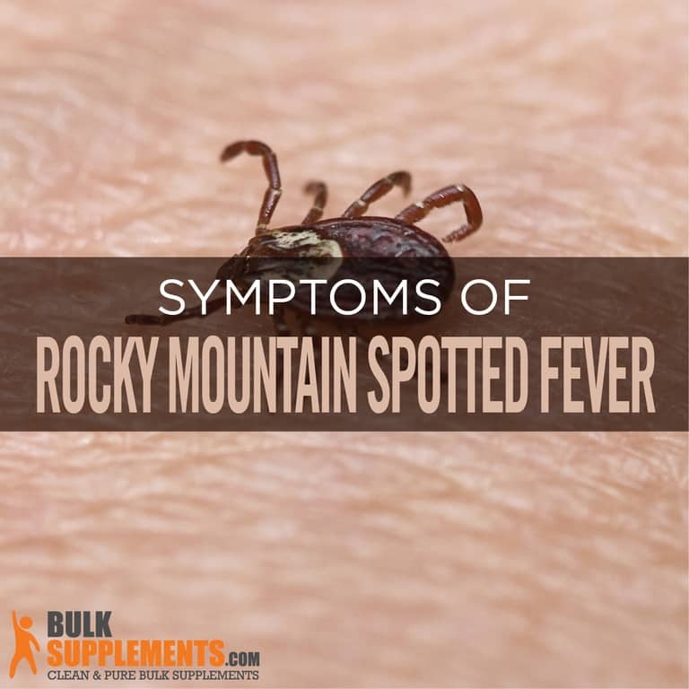 Rocky Mountain Spotted Fever Causes, Symptoms & Treatment