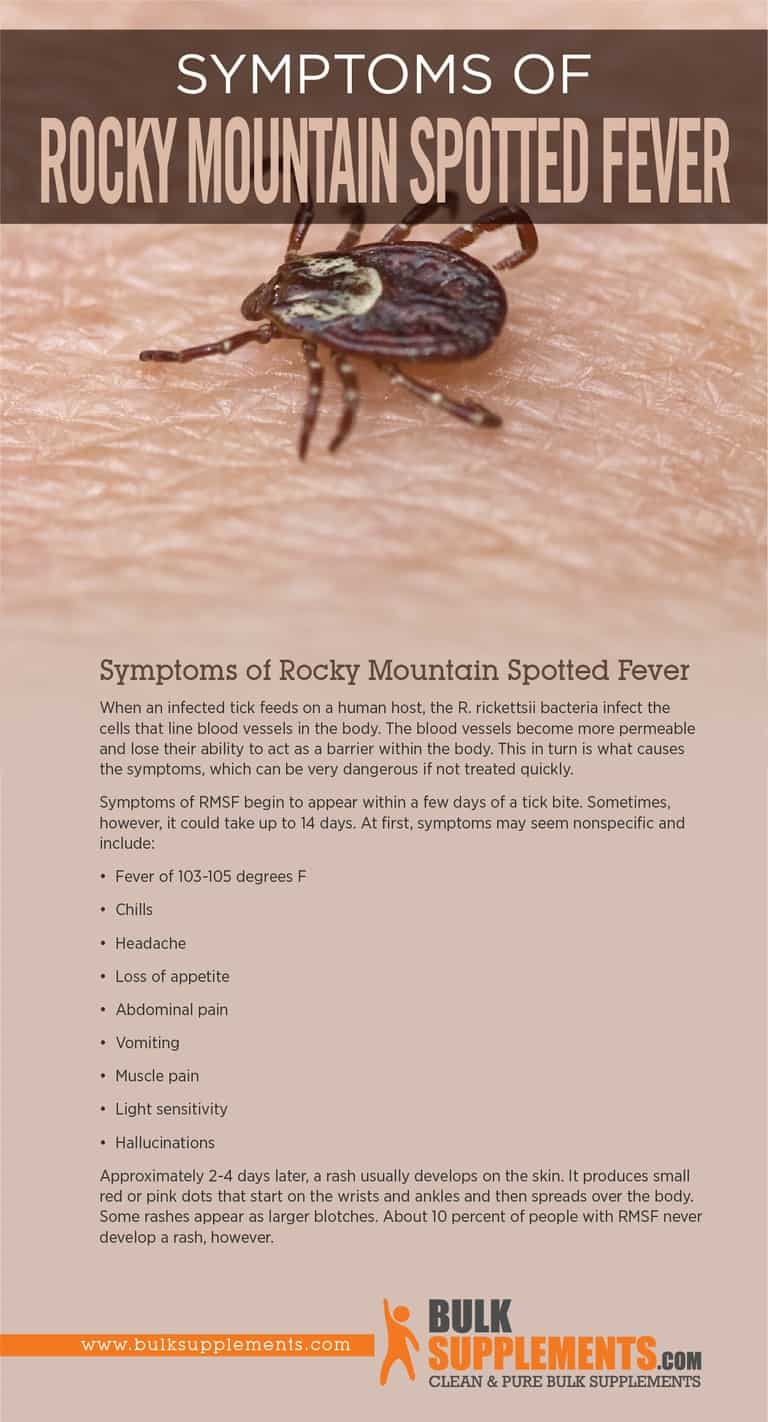 Rocky Mountain Spotted Fever Causes, Symptoms & Treatment