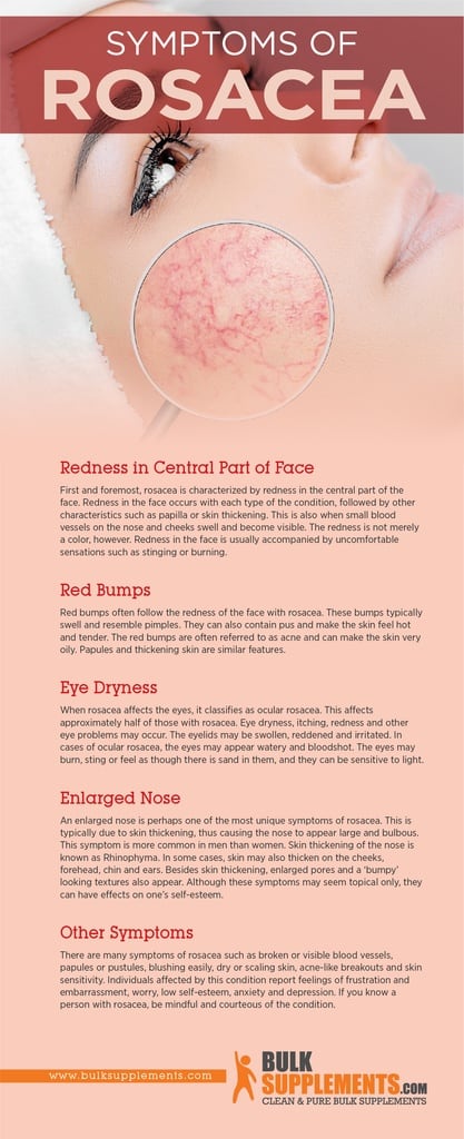 Rosacea: Symptoms, Causes & Treatment