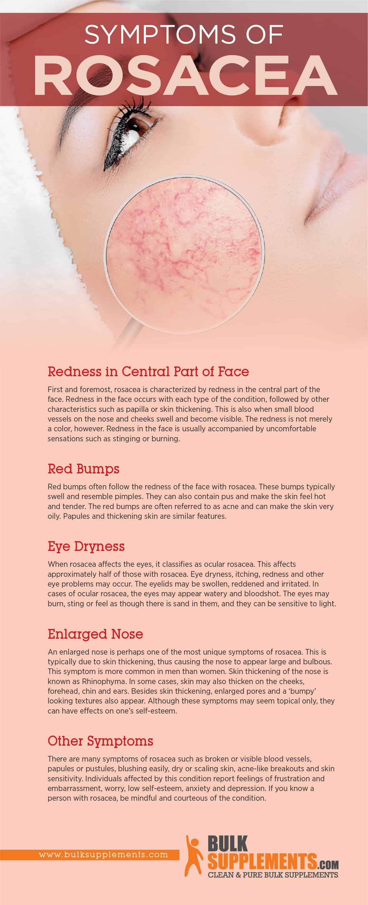 rosacea nose bumps