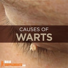 genital warts symptoms Archives