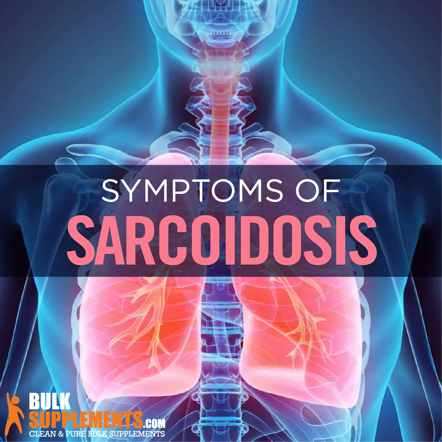 Sarcoidosis: Causes, Symptoms, Diagnosis & Treatment