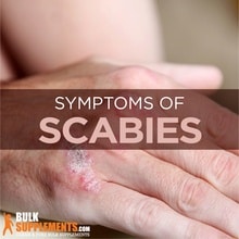 Scabies: Symptoms, Causes & Treatment