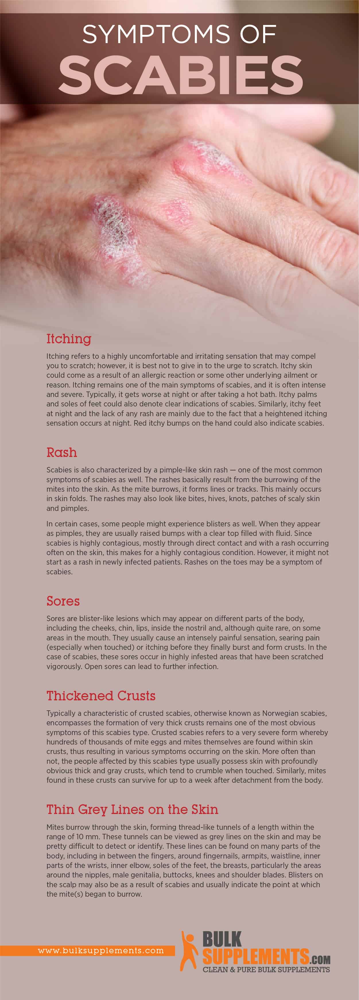 Symptoms of Scabies