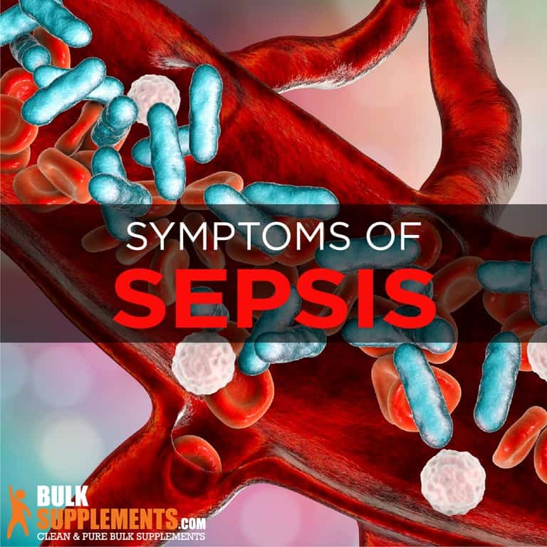 Sepsis Symptoms, Causes & Treatment