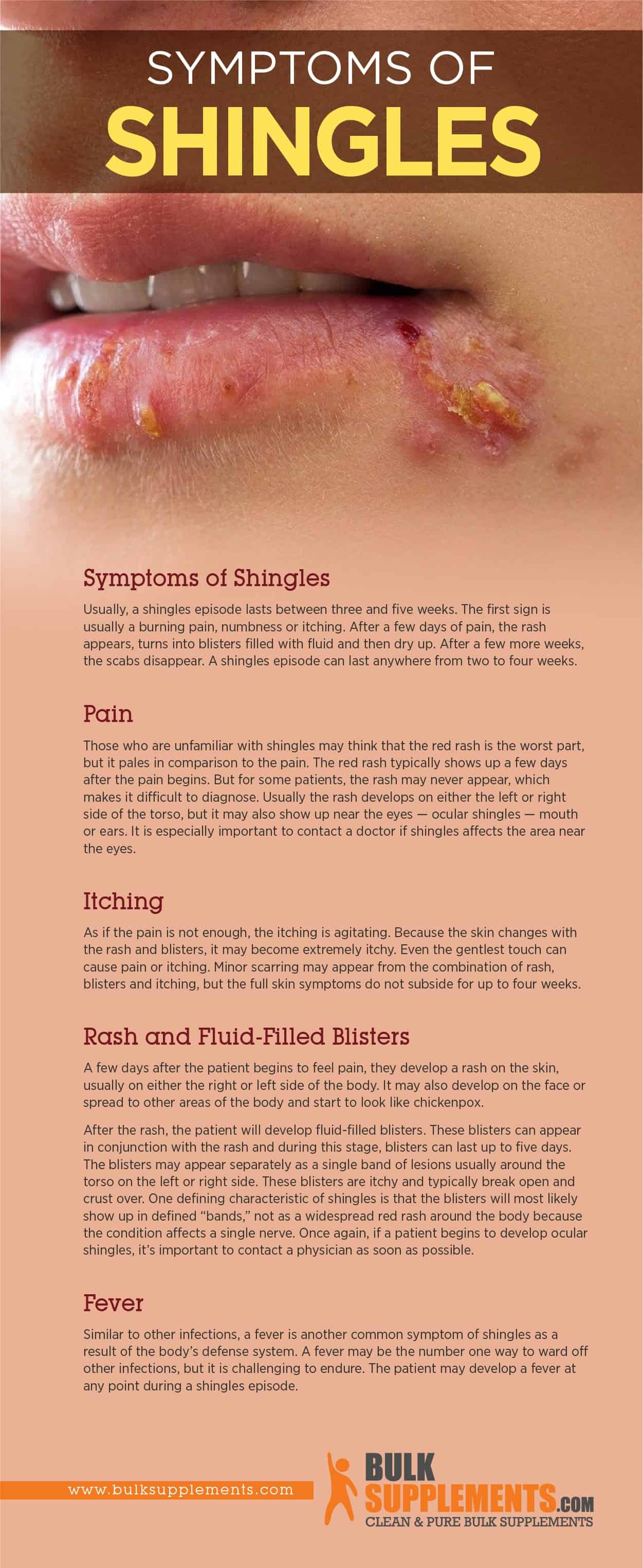 shingles symptoms treatment