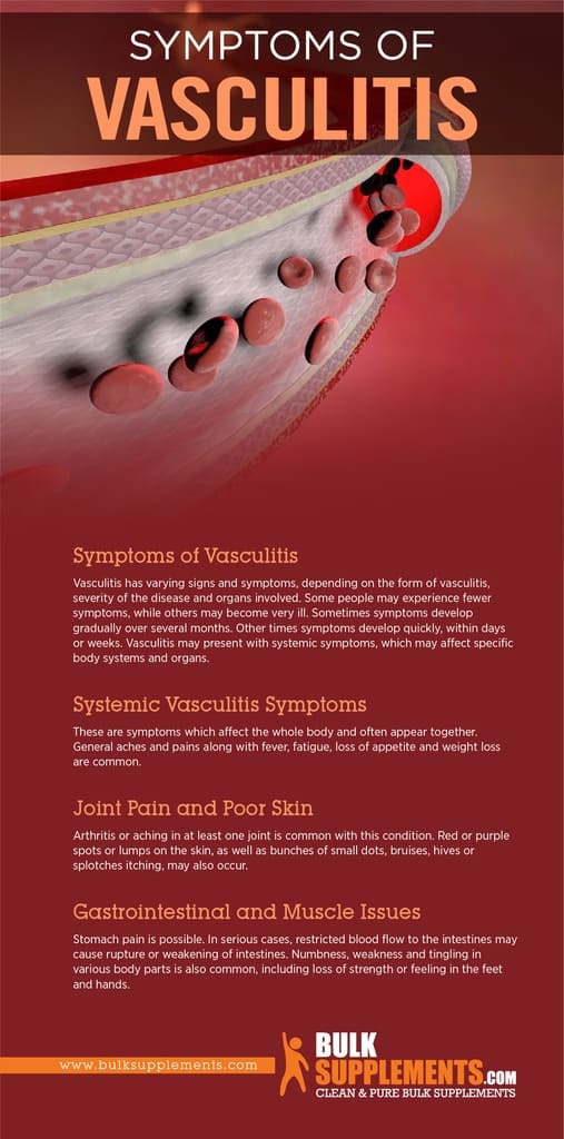 Vasculitis Symptoms Causes Treatment